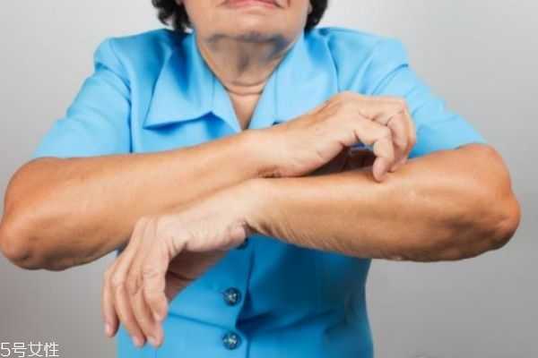 一到冬天皮肤就发痒是皮肤病吗 一到冬天皮肤就发痒是皮肤病吗