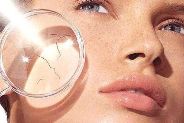 皮肤干燥的症状有哪些