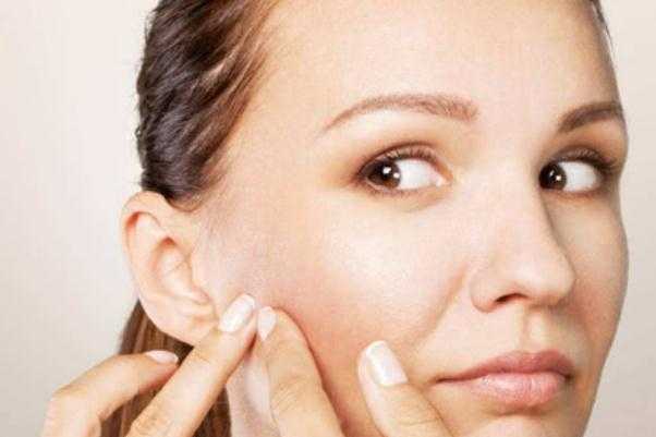 粉刺会疼吗 粉刺会疼是为什么