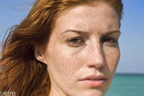 脸上有斑点用什么遮瑕效果好？口碑好的遮斑产品推荐