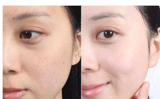 修复面膜几天用一次 修复面膜几天用一次