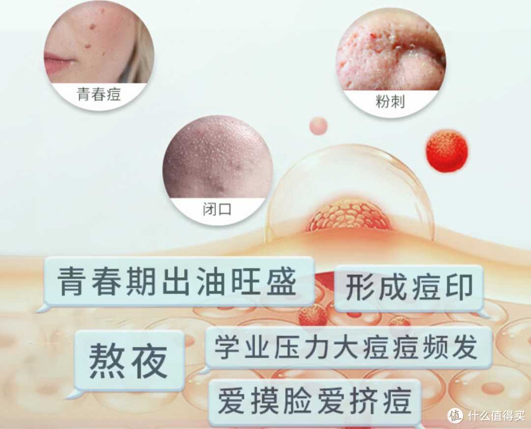 刷酸堪比换皮？什是刷酸？你适合吗？关于刷酸的科普篇！