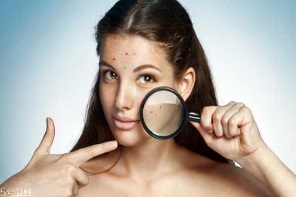 毛孔粗大用什么精华液 毛孔粗大用什么精华液