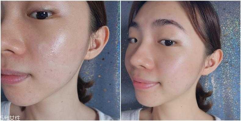 mad hippie维a精华适合什么肤质