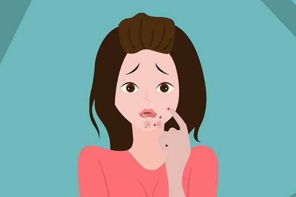 痘痘挤了变黑了是怎么回事 痘痘挤了后变成肉疙瘩怎么办