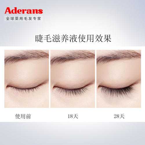 爱德兰丝睫毛增长液好用吗?爱德兰丝睫毛增长液安全吗 爱德兰丝睫毛增长液好用吗?爱德兰丝睫毛增长液安全吗