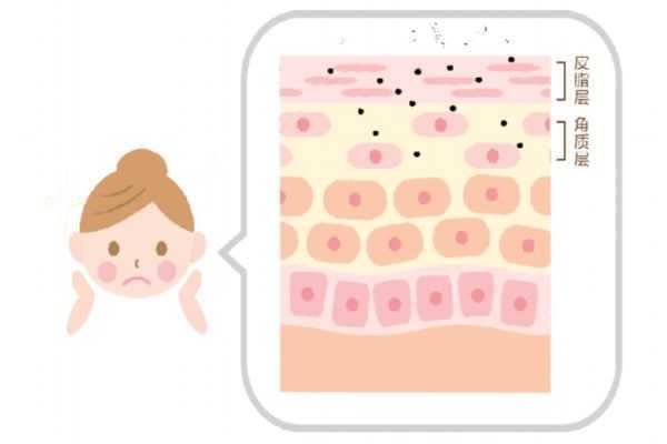 敏感肌肤怎么修复好