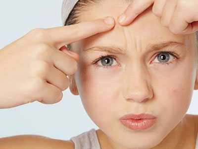 如何彻底根治脸上顽固的粉刺