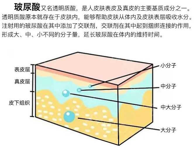 玻尿酸是什么做的?简单易懂的解释 玻尿酸是什么做的?简单易懂的解释