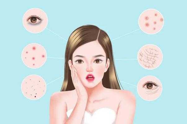 刷酸可以收缩毛孔吗 刷酸后脸上长了好多小痘痘