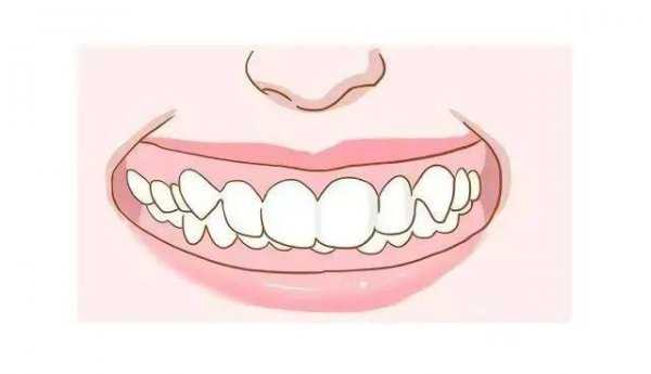 嘴角两边的纹叫什么纹