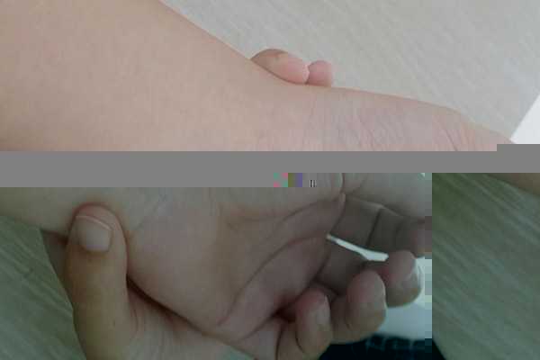 银饰戴着发黑代表身体不好吗