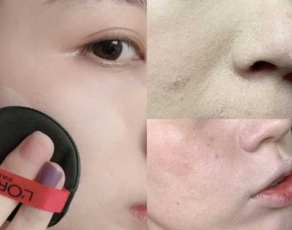 皮肤卡粉浮粉是什么原因