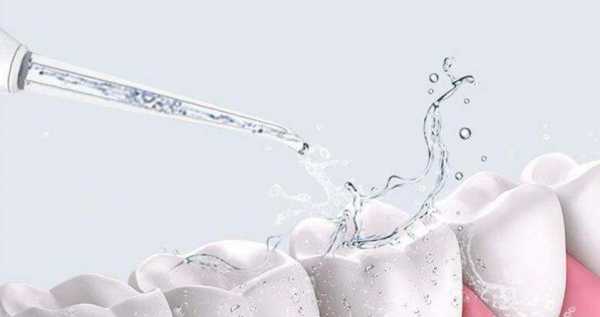 冲牙器什么牌子质量好