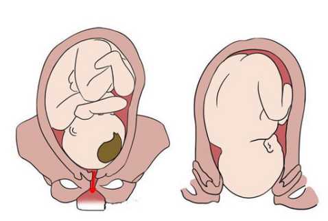产后多久下面会变紧