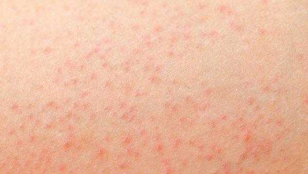 竹凉席怎么清洗去螨虫