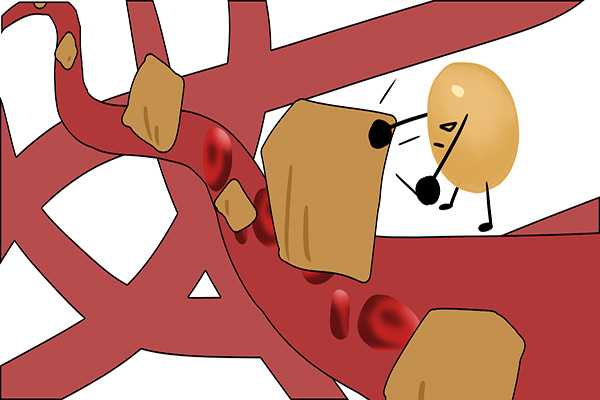 人去世前的征兆有哪些