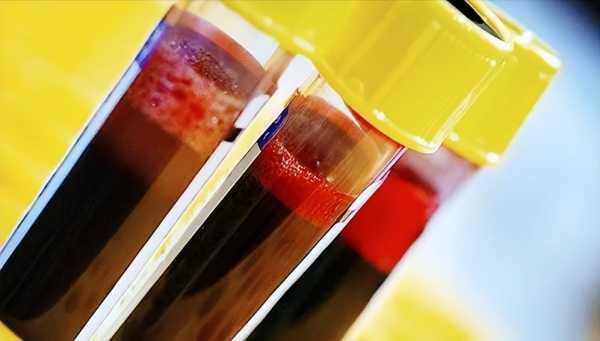 为什么国家不普及储存脐带血