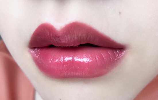 乳腺癌最爱惹哪些人